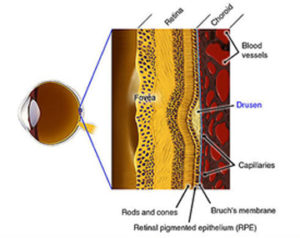 Retinal Pigment Epithelial (RPE) cells 
