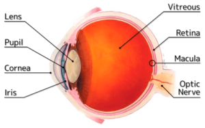 Macular Edema Diagram